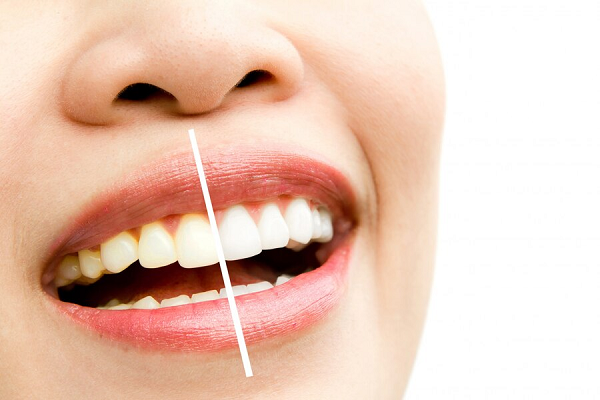 Cosmetic Dentistry